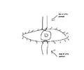 Lens.webp