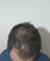 20250307_200507.webp 20250307_200507.webp