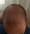 20250730_235135.webp