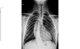 teletip_1773655869497.webp