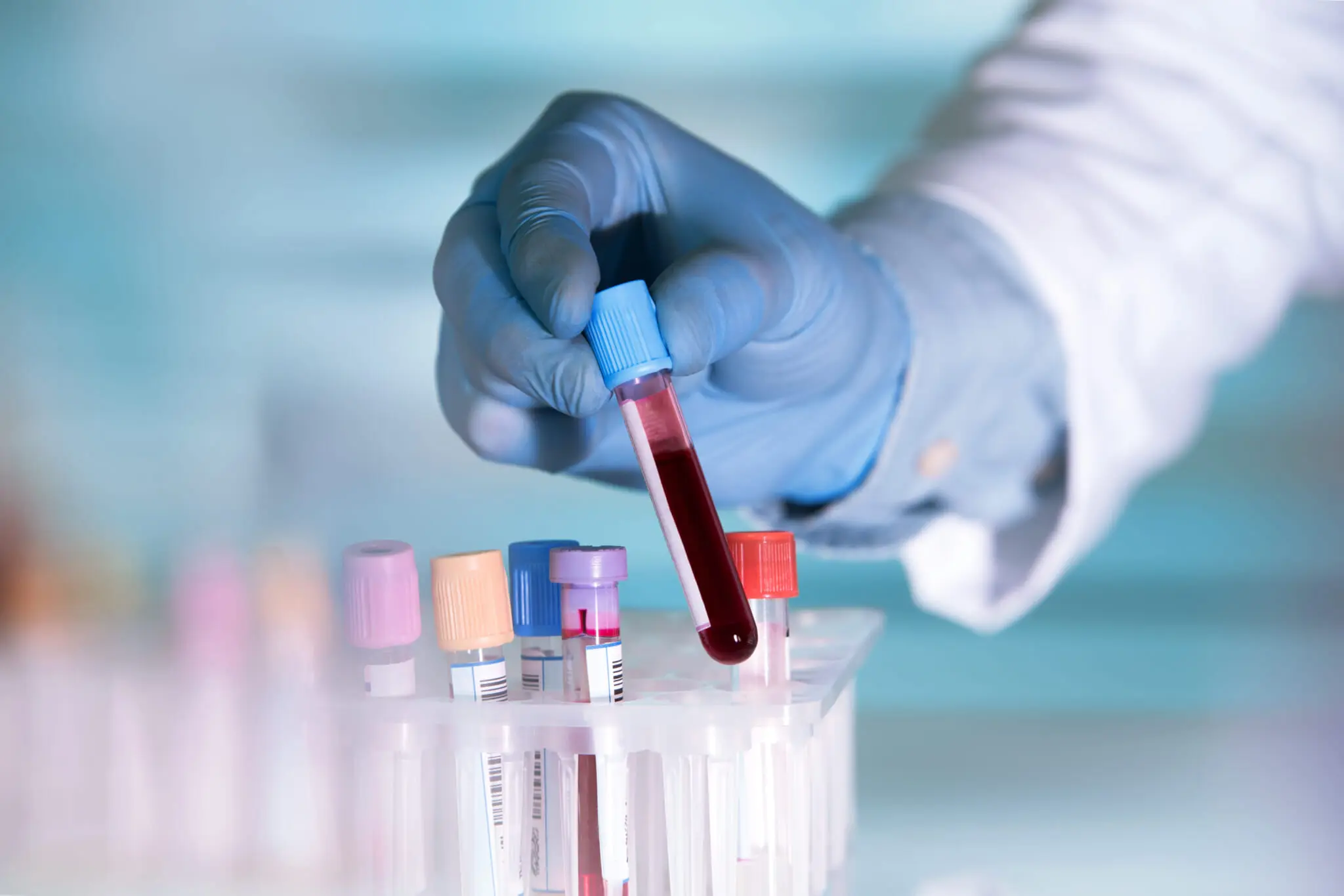 artificial-blood-2048x1365.jpg.webp