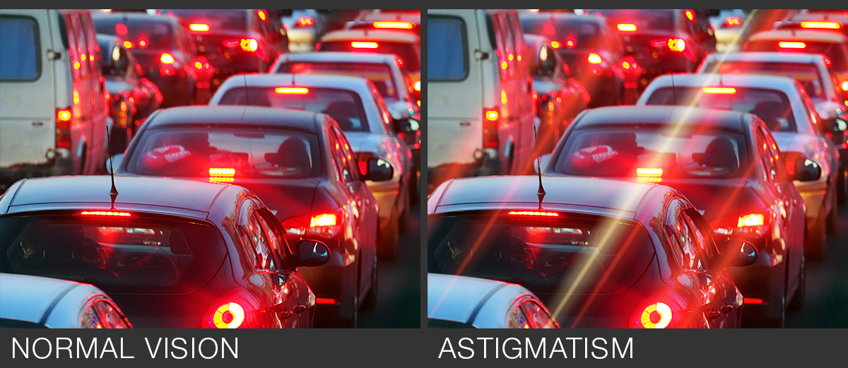 CMPOP_astigmatism_Eng_hor.webp