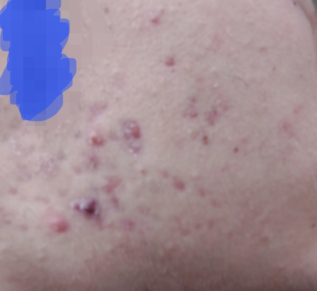 Screenshot_20260319_182014_Gallery.webp