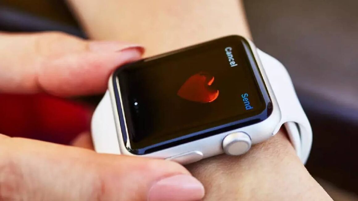 Apple Watch 1